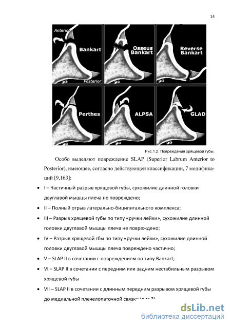 Разрыв суставной губы - лечение, симптомы, причины, диагностика | Центр Дикуля